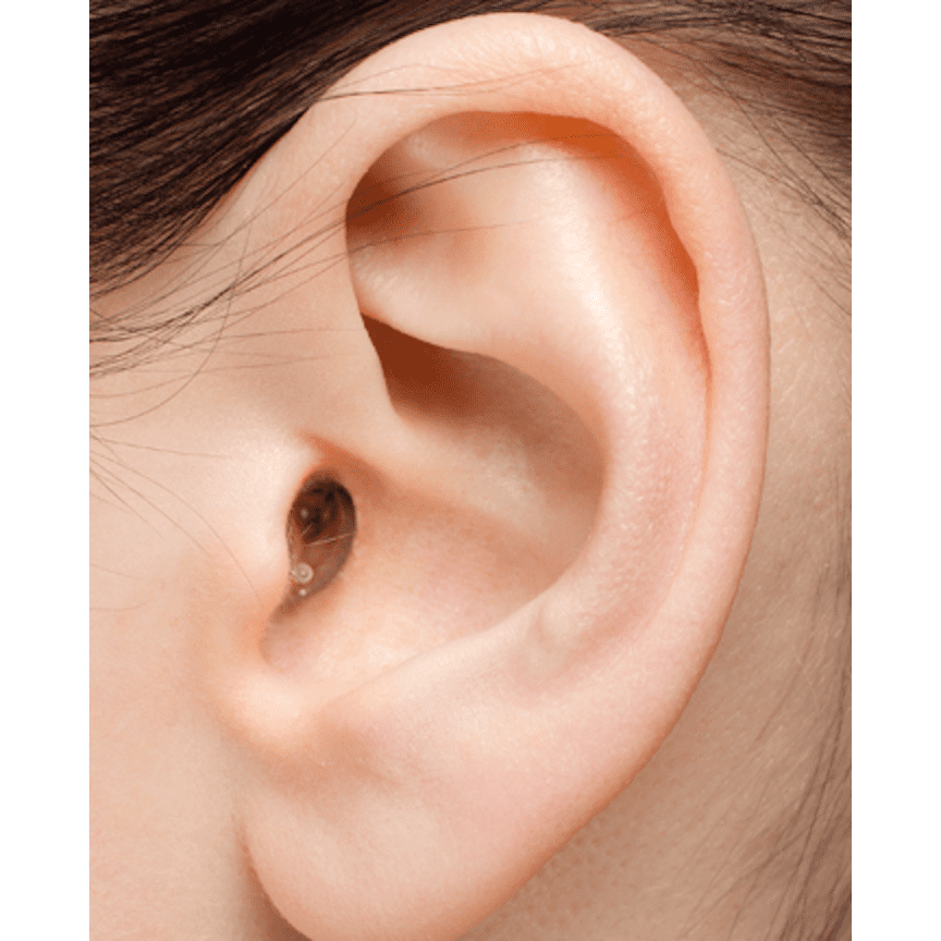 EARasers Musician's HiFi Earplugs-Large